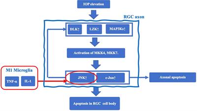 Glaucoma and microglia-induced neuroinflammation